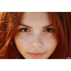 کک و مک | روش های گیاهی درمان این لکه های پوستی- بخش 1