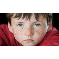 کک و مک | روش های گیاهی درمان این لکه های پوستی- بخش 2