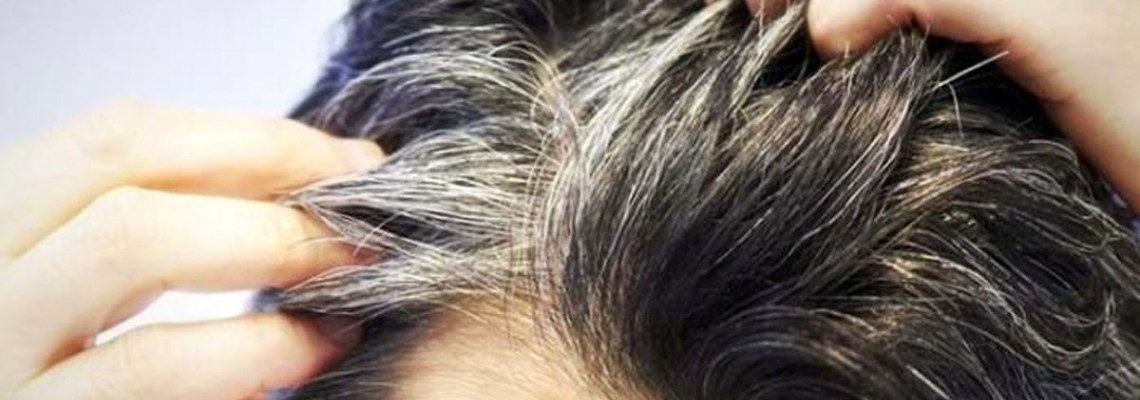 درمان سفیدی موها | روش هایی در دسترس برای سیاه کردن موهای سر