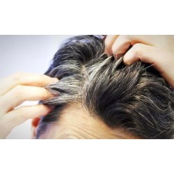 درمان سفیدی موها | روش هایی در دسترس برای سیاه کردن موهای سر