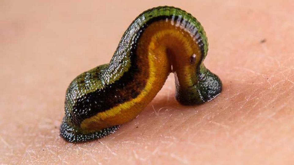 درمانی فواید زالو درمانی | تاثیر و نقش زالو در سلامت پیشگیری و بیماریها